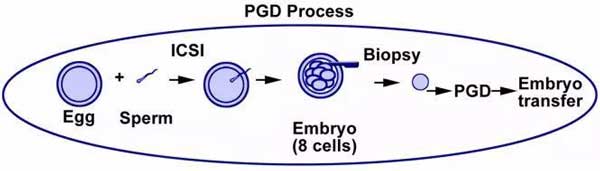 PGD技术操作方式